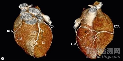 心血管器械研發(fā)為什么那么難？