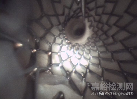 【創(chuàng)新醫(yī)械】MicroAngioscope：一次性血管內鏡獲批上市