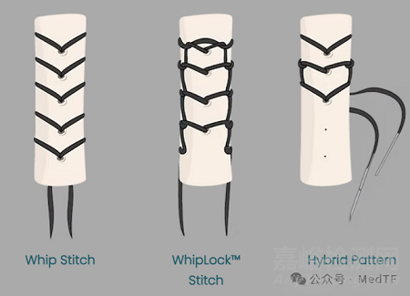 【創(chuàng)新醫(yī)械】EasyWhip：可拆卸的縫合針，高強(qiáng)度高效肌腱縫合