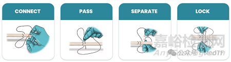【創(chuàng)新醫(yī)械】EasyWhip：可拆卸的縫合針，高強(qiáng)度高效肌腱縫合