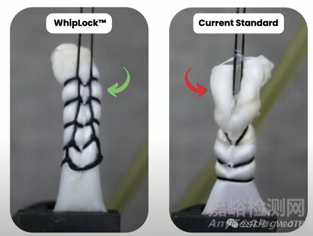 【創(chuàng)新醫(yī)械】EasyWhip：可拆卸的縫合針，高強(qiáng)度高效肌腱縫合