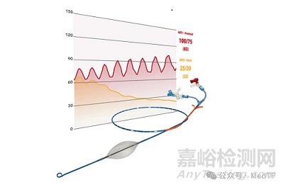 【創(chuàng)新醫(yī)械】pREBOA PRO：美軍相中的主動脈球囊阻斷止血神器獲批FDA