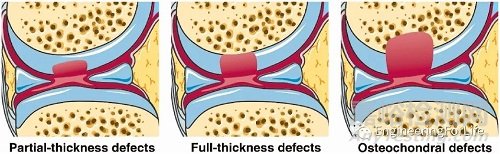 如何評價水凝膠的成軟骨能力？