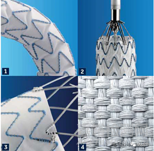 【創(chuàng)新醫(yī)械】美敦力Endurant：FDA批準(zhǔn)首個(gè)且唯一用于腹主動(dòng)脈瘤破裂覆膜支架