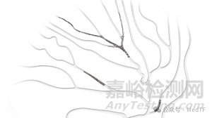 Penumbra推出類似“液態(tài)金屬”新的彈簧圈