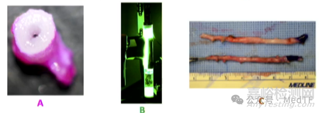 【創(chuàng)新醫(yī)械】PTP：光固化大隱靜脈減輕冠脈搭橋“橋血管”擴(kuò)張 ，大幅降低“橋血管”失敗率