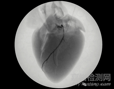 【創(chuàng)新醫(yī)械】Liquid Wire：水凝膠起搏導線獲FDA“突破性設備”稱號，起搏導線革命