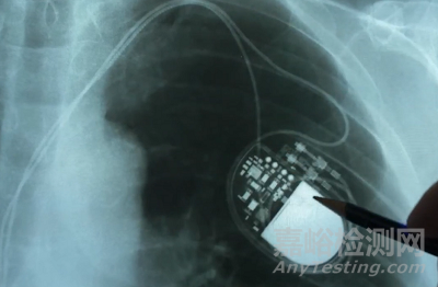 Rhythio Medical可注射水凝膠電極系統(tǒng)獲FDA突破性設(shè)備認(rèn)定