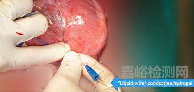 Rhythio Medical可注射水凝膠電極系統(tǒng)獲FDA突破性設(shè)備認(rèn)定