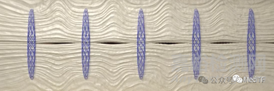 【創(chuàng)新醫(yī)械】DURAMESH:全球唯一的網(wǎng)狀縫線獲批上市