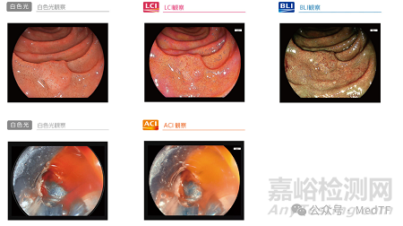 ELUXEO 8000:富士推出最新內(nèi)鏡系統(tǒng)