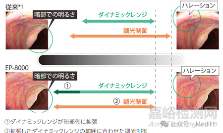 ELUXEO 8000:富士推出最新內(nèi)鏡系統(tǒng)