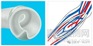 【創(chuàng)新醫(yī)械】螺旋狀人工血管獲FDA批準上市