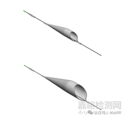 【創(chuàng)新醫(yī)械】Recana：用于靜脈支架再狹窄的取栓導(dǎo)管獲批FDA，遠(yuǎn)端帶有栓塞收集器\