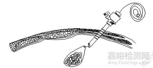 一次性使用內(nèi)窺鏡用活檢袋研發(fā)實驗要求與主要風(fēng)險