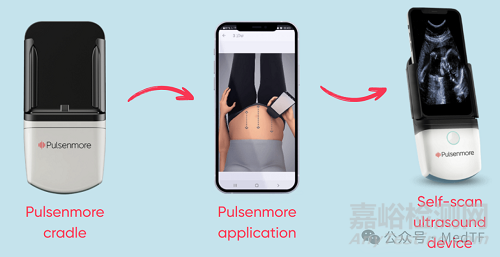 Pulsenmore宣布其家用產(chǎn)前超聲平臺(tái)Pulsenmore ES獲批FDA
