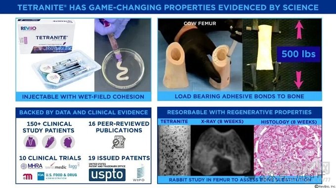 【創(chuàng)新醫(yī)械】FDA批準(zhǔn)首款可再生膠水用于骨折臨床研究