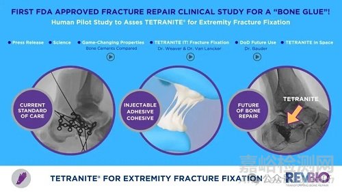 【創(chuàng)新醫(yī)械】FDA批準(zhǔn)首款可再生膠水用于骨折臨床研究