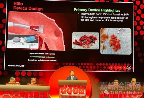 Hēlo：安全性有效性均遠超預期，超大口徑抽吸導管