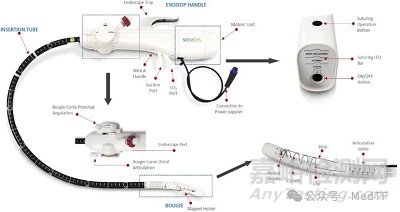 EndoZip:全自動(dòng)縫合減肥神器獲批上市