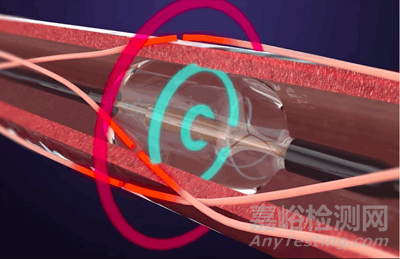 TCT2025:全球心脈技術(shù)亮點全梳理