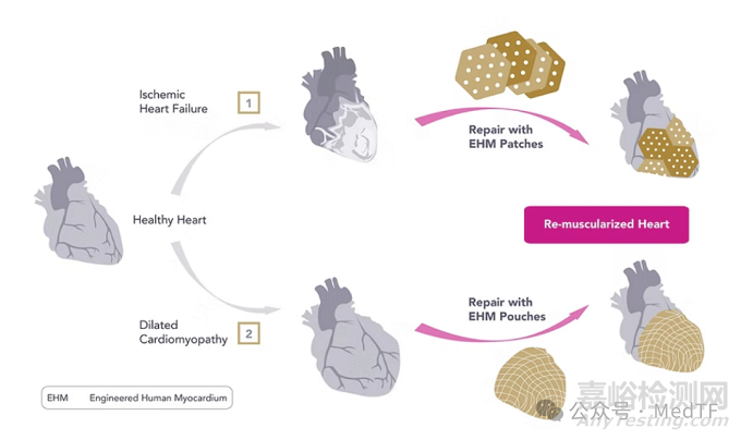 【創(chuàng)新醫(yī)械】BioVAT：可逆轉(zhuǎn)心衰的心臟補片