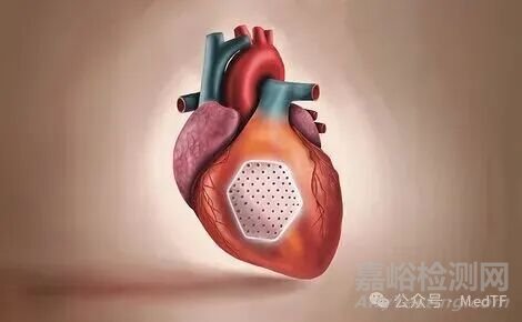 【創(chuàng)新醫(yī)械】BioVAT：可逆轉(zhuǎn)心衰的心臟補片