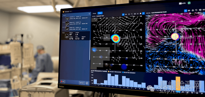 波科開啟自己房顫標測+PFA臨床研究，不再依賴強生和雅培三維標測