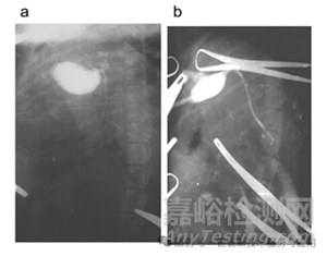 稀土元素鉭酸鹽及其固溶體的新型 X 射線造影劑研究進(jìn)展