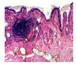 稀土元素鉭酸鹽及其固溶體的新型 X 射線造影劑研究進(jìn)展