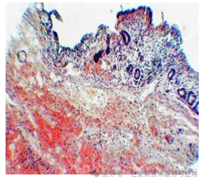 稀土元素鉭酸鹽及其固溶體的新型 X 射線造影劑研究進(jìn)展