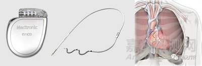 APHRS：美敦力公布兩項(xiàng)除顫突破性新臨床研究