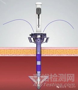 【創(chuàng)新醫(yī)械】國產(chǎn)穿刺、縫合二合一的新型腹壁穿刺縫合器