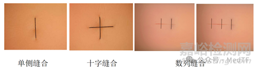 【創(chuàng)新醫(yī)械】國產(chǎn)穿刺、縫合二合一的新型腹壁穿刺縫合器