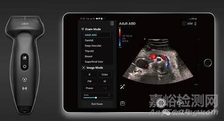 邁瑞推出全身無線手持超聲TE Air e5M