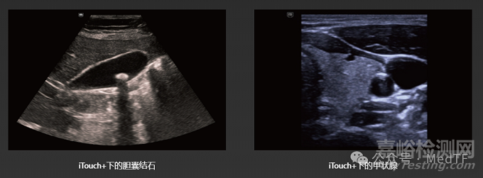 邁瑞推出全身無線手持超聲TE Air e5M