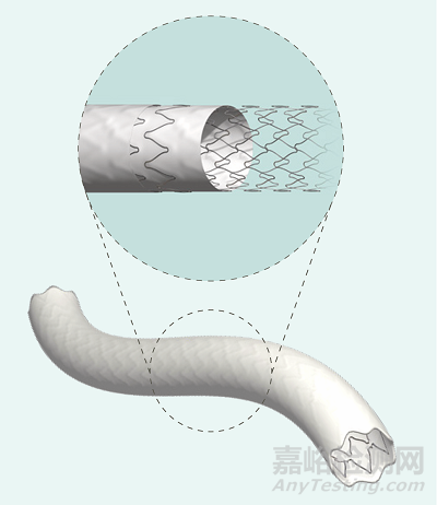 78mm超長規(guī)格主動脈覆膜支架獲批CE