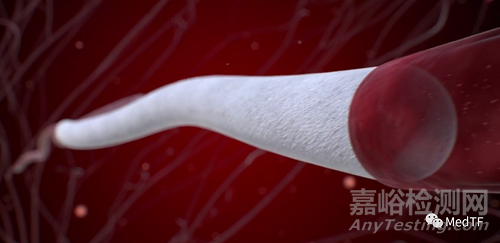 aXess:可再生人工血管一年通暢率為100%