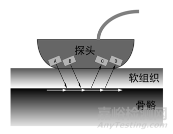 剛剛，超聲骨密度儀注冊(cè)審查指導(dǎo)原則（2025年修訂版）正式發(fā)布