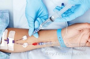 血管通路醫(yī)療器械技術(shù)、產(chǎn)品與市場分析