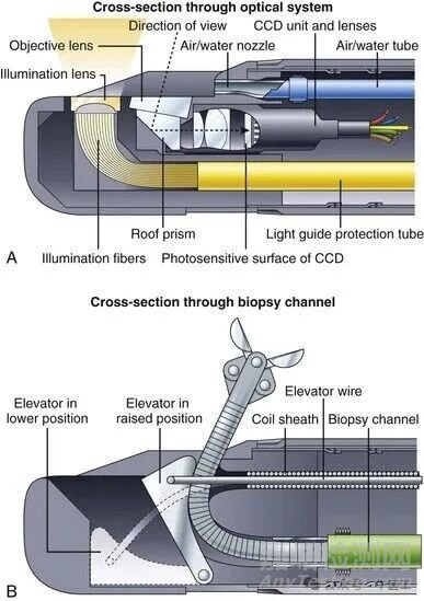 軟性內(nèi)窺鏡的工作原理及結(jié)構(gòu)圖