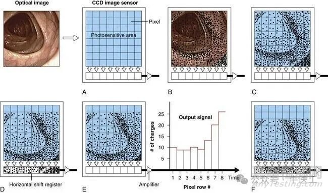 軟性內(nèi)窺鏡的工作原理及結(jié)構(gòu)圖