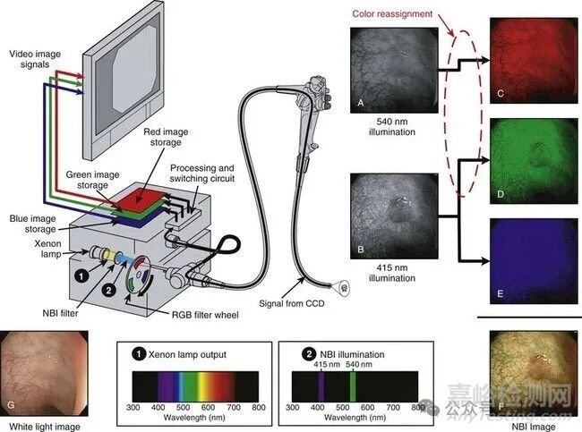 軟性內(nèi)窺鏡的工作原理及結(jié)構(gòu)圖