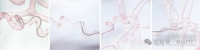 【創(chuàng)新醫(yī)械】SmartGUIDE：實時可調(diào)彎神經(jīng)介入導(dǎo)絲獲批上市