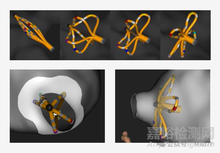 波科首款具有標測功能的PFA消融導管獲批NMPA