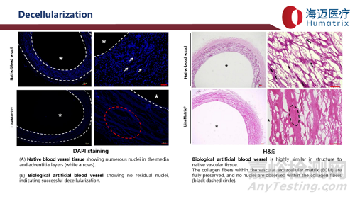 國產(chǎn)首款完全生物型小口徑人工血管技術(shù)解析