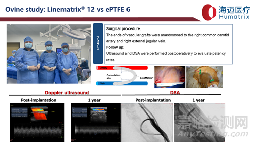 國產(chǎn)首款完全生物型小口徑人工血管技術(shù)解析