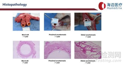 國產(chǎn)首款完全生物型小口徑人工血管技術(shù)解析