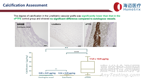國產(chǎn)首款完全生物型小口徑人工血管技術(shù)解析