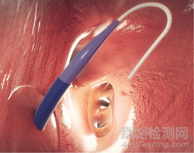 【創(chuàng)新醫(yī)械】首款“零交換+阻抗引導”經(jīng)房間隔通路系統(tǒng)獲批FDA